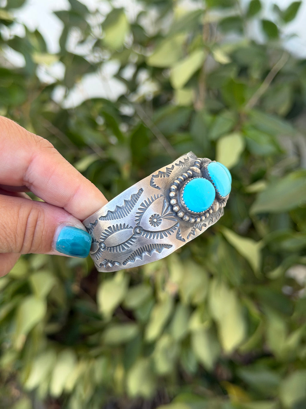 Kingman cuff
